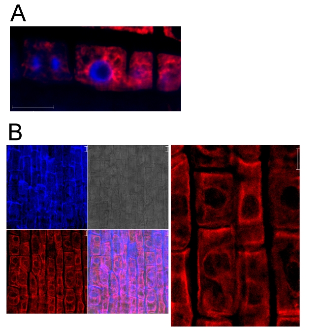 Immunofluorescence using plant anti-BiP antibody